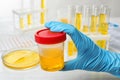 Laboratory worker holding jar with urine near table. Urology concept