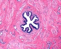 Human breast. Lactiferous duct