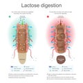 Lactose digestion. Water is added during digestion and reabsorb in the body. Bacteria fermenter eating lactose. Toxic residue abso