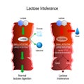 Lactose intolerance or lactose digestion. Small and large intestine