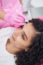 Lady on forehead is schematically marked with pencil for procedure