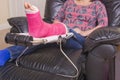 Lady with Fractured Leg Royalty Free Stock Photo