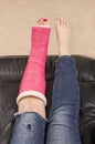 Lady with Fractured Leg Royalty Free Stock Photo