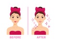 Lady with Problem Skin. Treatment of Acne, Pimples. Before After. Woman in Towel and with Bow on Head. Female Happy Character with