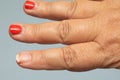 Lady's hand with ruined nail polish on the nails. Semi-permanent nail polish to be redone Royalty Free Stock Photo