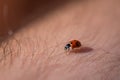 Ladybug crawling between hair on a person`s arm