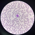 Monocyte white blood cells on center