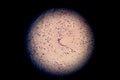 Langerhans cells LC in microscopic slide