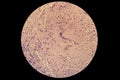 Langerhans cells LC in microscopic slide