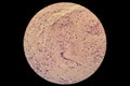 Langerhans cells LC in microscopic slide Royalty Free Stock Photo