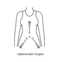 Laparoscopic surgery icon line in vector, illustration of a medical procedure.