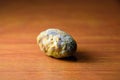 Large gallstone, Gall bladder stone. The result of gallstones