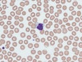 Large granular lymphocyte