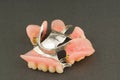 Large image of a modern arc denture with attachmens Royalty Free Stock Photo