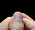 Large lunulae or half-moon at fingernail with vertical lines of Asian, Chinese old man