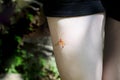 A large mosquito is sitting on the girl`s leg .Culex modestus is one of the most common types of mosquitoes,their bites are