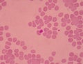 Large platelets on blood smear.