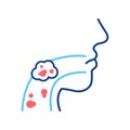 Laryngeal cancer line color icon. Human organ concept. Malignant neoplasm. Sign for web page, mobile app, button, logo