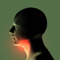 Laryngitis vector illustration. Human throat irritation.