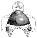 Larynx pouches of the orangutang.