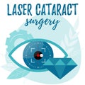 Laser cataract surgery illustration. Refractive lens exchange concept.