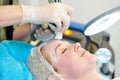 Laser cosmetology treatment Royalty Free Stock Photo