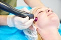 Laser cosmetology treatment Royalty Free Stock Photo