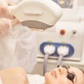 Laser elos medical device. Remove unwanted hair and asteriks. Cosmetology