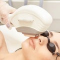 Laser elos medical device. Remove unwanted hair and asteriks. Cosmetology spa procedure at salon. Chin facial depilation