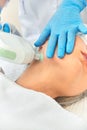 Laser facial skin rejuvenation in women