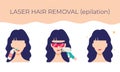 Laser hair removal on the face