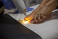 Laser nail fungus treatment