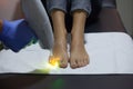 Laser nail fungus treatment