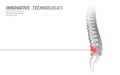 Laser physiotherapy human spine injury. Pain area surgery operation modern loin medicine technology low poly triangles