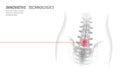 Laser physiotherapy human spine. Pain area surgery operation modern medicine technology low poly triangles 3D render
