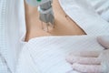 Laser removal of neoplasms is a non-surgical method for removing skin formations