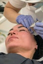 Laser skin rejuvenation, eyelid correction, pigmentation removal, close-up