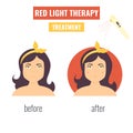 Laser skin rejuvenation. Red light therapy Royalty Free Stock Photo