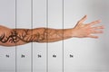 Laser Tattoo Removal On Man`s Hand Royalty Free Stock Photo