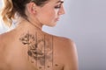 Laser Tattoo Removal On Woman`s Shoulder Royalty Free Stock Photo