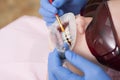 Laser teeth whitening. People, medicine, stomatology and health care concept - close up of female dentist with dental