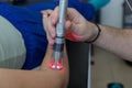 Laser therapy in hand used to treat pain.