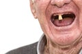 Last Teeth Royalty Free Stock Photo