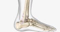 Lateral Ankle Sprain Torn Anterior Talofibular Ligament