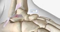 Lateral Ankle Sprain Torn Anterior Talofibular Ligament Royalty Free Stock Photo
