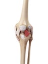 The lateral patellar ligament