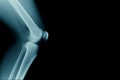 Lateral view of human knee joint Royalty Free Stock Photo