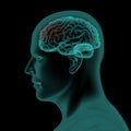 Lateral x-ray scan view of human head and brain Royalty Free Stock Photo