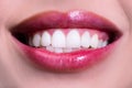 Laughing woman mouth with great teeth. Perfect smile after bleaching. Dental care and whitening teeth. Healthy smile Royalty Free Stock Photo