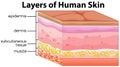 Layers of human skin concept Royalty Free Stock Photo